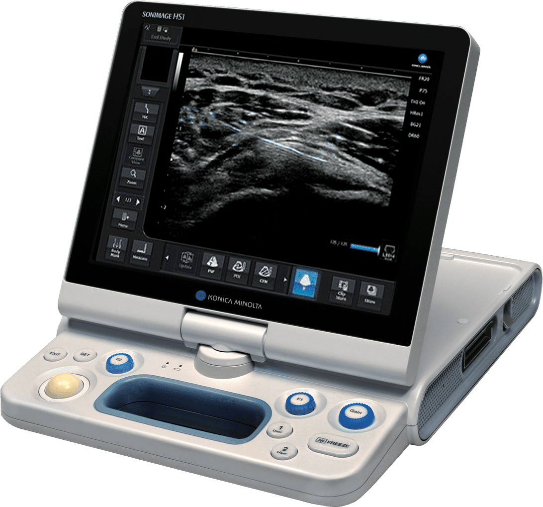 Ultrasound Technology - Superior Detail, Portability ...